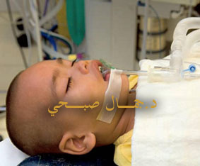 عمليات الحول 